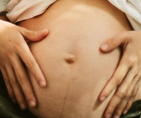 Zwei Hände umfassen den Bauch einer Frau